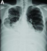What is your diagnosis? - January 2019